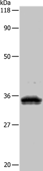 UPK3B Antibody in Western Blot (WB)