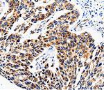 COX16 Polyclonal Antibody