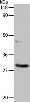 APIP Antibody in Western Blot (WB)