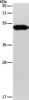 KRT81 Antibody in Western Blot (WB)