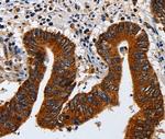 Cytokeratin 23 Polyclonal Antibody