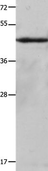 Cytokeratin 23 Antibody in Western Blot (WB)