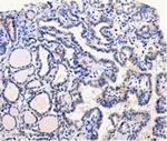 ARL6 Polyclonal Antibody