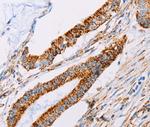ATP5J Polyclonal Antibody