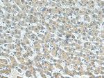 BTG3 Antibody in Immunohistochemistry (Paraffin) (IHC (P))