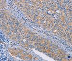 Calpain 7 Polyclonal Antibody