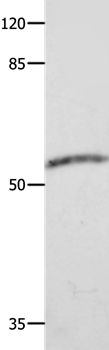 CAP2 Antibody in Western Blot (WB)