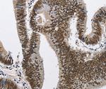 CMTM2 Antibody in Immunohistochemistry (Paraffin) (IHC (P))