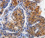 CLCA4 Antibody in Immunohistochemistry (Paraffin) (IHC (P))
