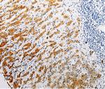 CLEC1B Polyclonal Antibody