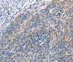 Cullin 7 Polyclonal Antibody