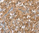 Cullin 7 Antibody in Immunohistochemistry (Paraffin) (IHC (P))