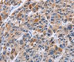ENPP5 Polyclonal Antibody