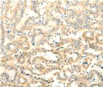 FOXR2 Antibody in Immunohistochemistry (Paraffin) (IHC (P))