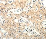 FOXR2 Polyclonal Antibody