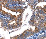 TBX22 Polyclonal Antibody