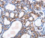 IGSF6 Polyclonal Antibody