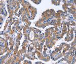 IGSF10 Polyclonal Antibody