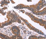 IRAK1BP1 Polyclonal Antibody