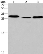 IRAK1BP1 Antibody in Western Blot (WB)