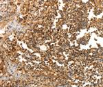 LRP12 Antibody in Immunohistochemistry (Paraffin) (IHC (P))