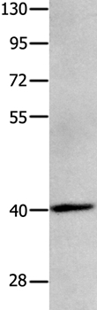 MAGEB4 Antibody in Western Blot (WB)
