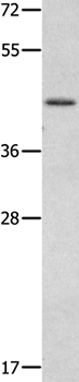 MMP28 Antibody in Western Blot (WB)