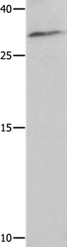 NAIF1 Antibody in Western Blot (WB)