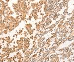 NAP1L1 Polyclonal Antibody