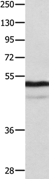 NAP1L1 Antibody in Western Blot (WB)
