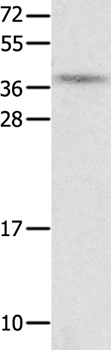 NTS Antibody in Western Blot (WB)