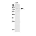 OAS2 Antibody in Western Blot (WB)