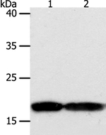 PDCD6 Antibody in Western Blot (WB)