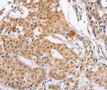Pirh2 Polyclonal Antibody