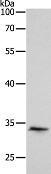 Pirh2 Antibody in Western Blot (WB)