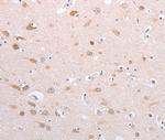 Profilin 4 Antibody in Immunohistochemistry (Paraffin) (IHC (P))