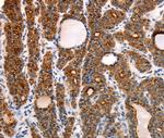 RAMP1 Polyclonal Antibody