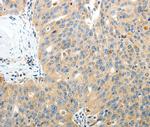 RAMP3 Antibody in Immunohistochemistry (Paraffin) (IHC (P))