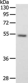 SCG3 Antibody in Western Blot (WB)