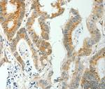 SELM Antibody in Immunohistochemistry (Paraffin) (IHC (P))