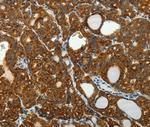 SELM Antibody in Immunohistochemistry (Paraffin) (IHC (P))