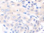 SOCS6 Polyclonal Antibody