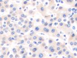 SOCS6 Antibody in Immunohistochemistry (Paraffin) (IHC (P))