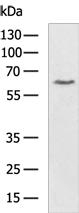 SOCS6 Antibody in Western Blot (WB)