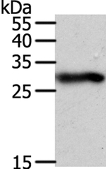 SPIN2 Antibody in Western Blot (WB)