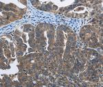 Synaptotagmin 3 Antibody in Immunohistochemistry (Paraffin) (IHC (P))