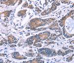 Synaptotagmin 4 Polyclonal Antibody