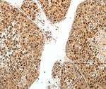 SPATA2L Polyclonal Antibody