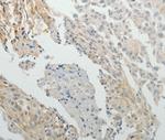 SPATA17 Polyclonal Antibody