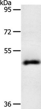 SPATA17 Antibody in Western Blot (WB)